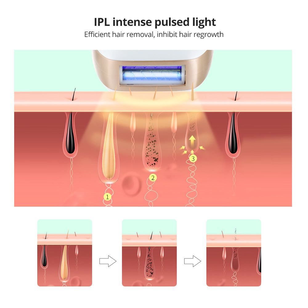 Hair Removal laser IPL intense pulsed light